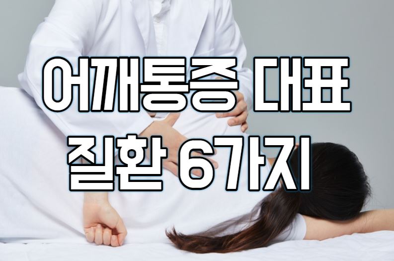  어깨 통증 대표 질환 6가지 증상과 원인