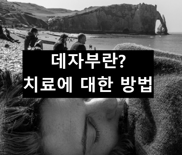 데자부 현상 발생 사례 및 치료 방법