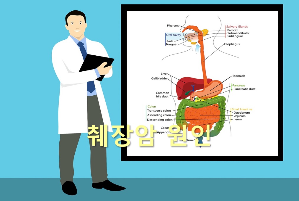  췌장암 증상과 췌장암 원인
