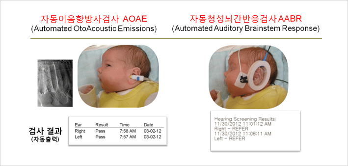 신생아-청각-선별검사
