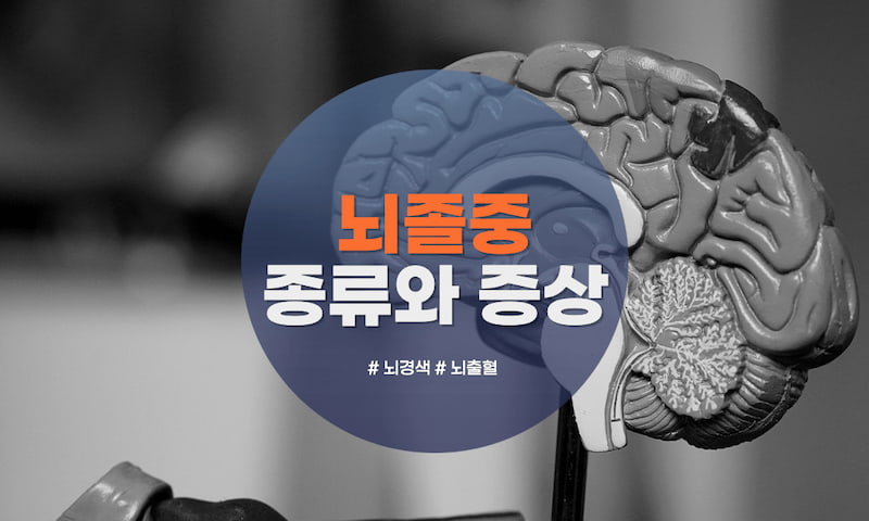  뇌졸중의 종류와 증상 간단 정리 (ft. 뇌경색, 뇌출혈)