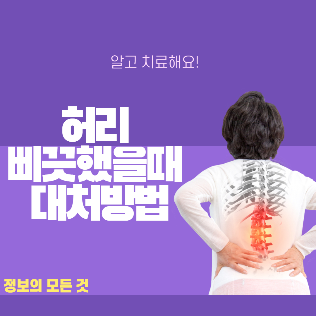  허리 삐끗했을때 대처방법