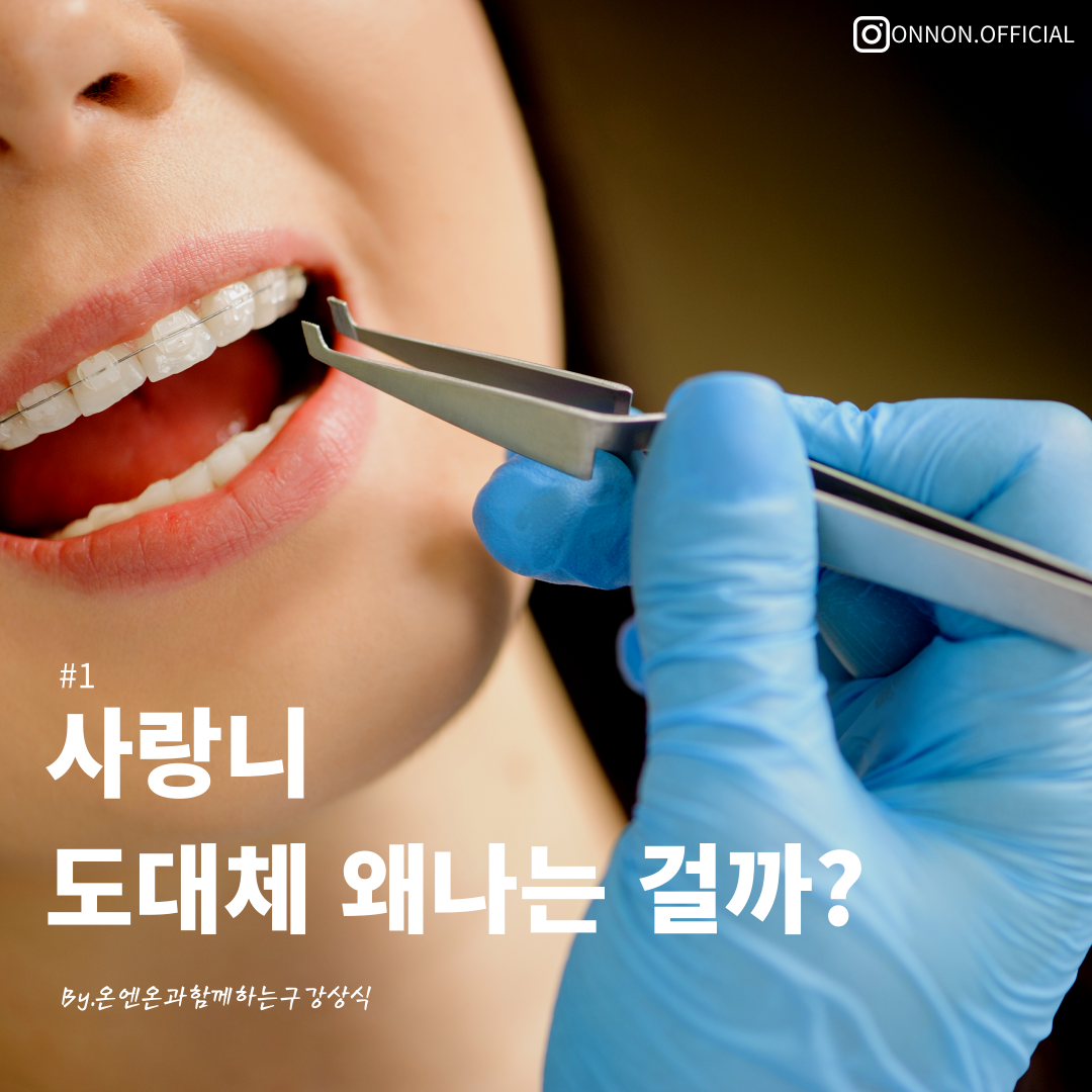  [구강정보] 사랑니 도대체 왜 나는걸까?? -사랑니 관리법-