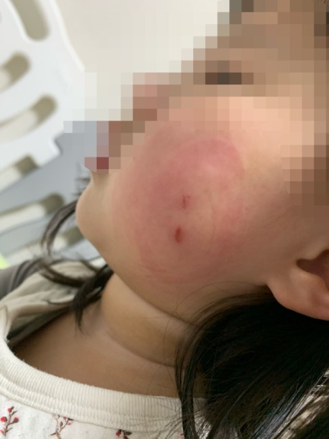  경도청북 신도시 예천 호명면 국·공립 어린이집 보육교사 아동학대 신고 접수, 호반, 우방센텀, 군립호명, 소담, 송이, 리움, 행복주택
