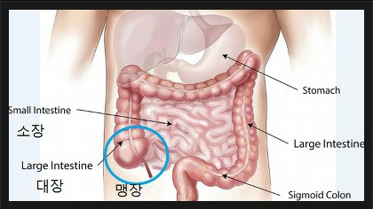  맹장위치 남자 여자 다를까?