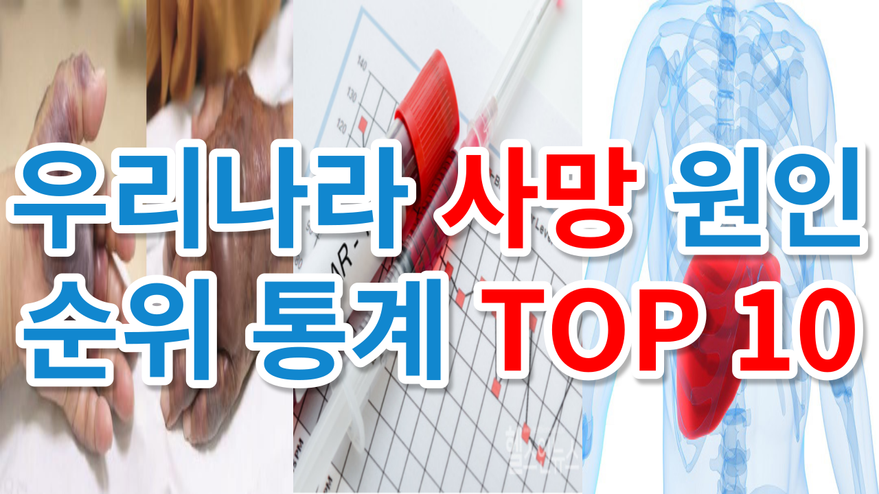 우리나라 사망 원인 순위 통계 TOP 10