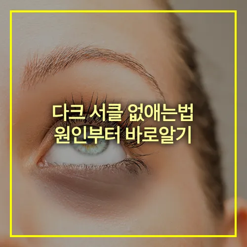 다크 서클 없애는법