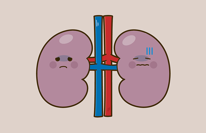 질환이-있는-신장의-모습