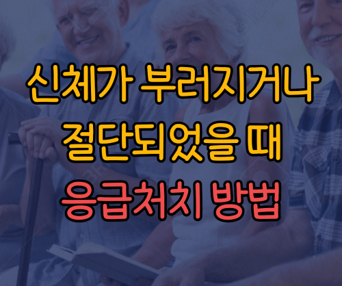 신체절단 시&#44; 응급처치방법