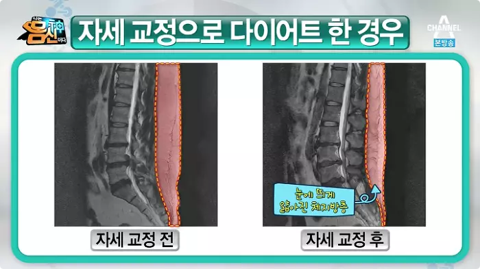 체형별 비만유형