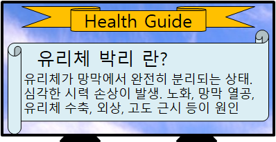 유리체 박리