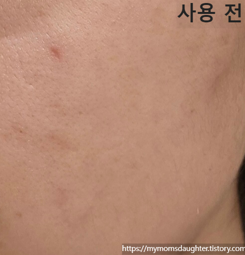 이니스프리 레티놀 앰플 사용 전