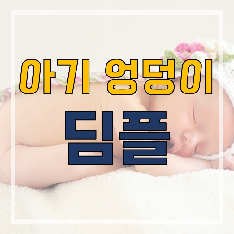  아기 엉덩이 딤플 검사 원인 치료 알려드립니다.