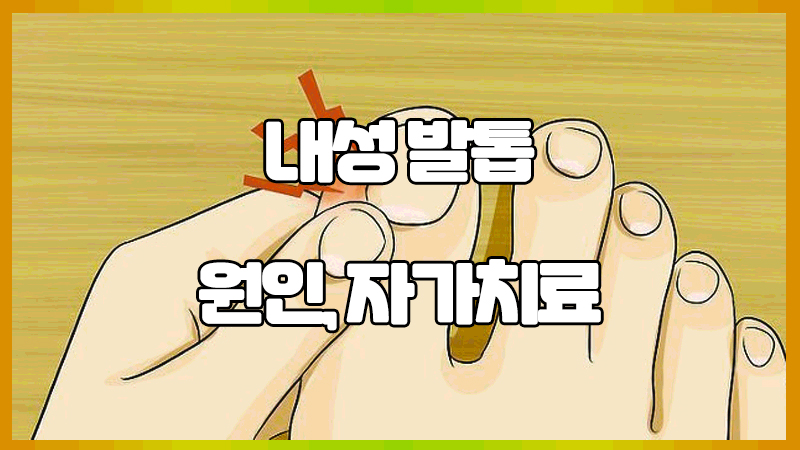  내성발톱 원인 및 자가치료 : 염증