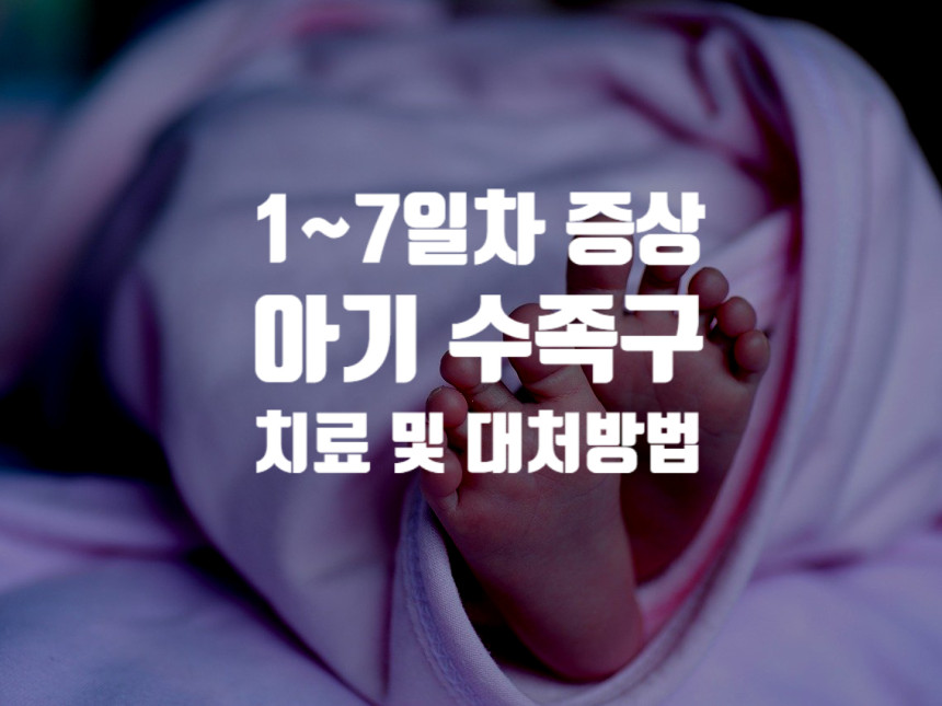 아기수족구 증상 - 대처방법 및 치료