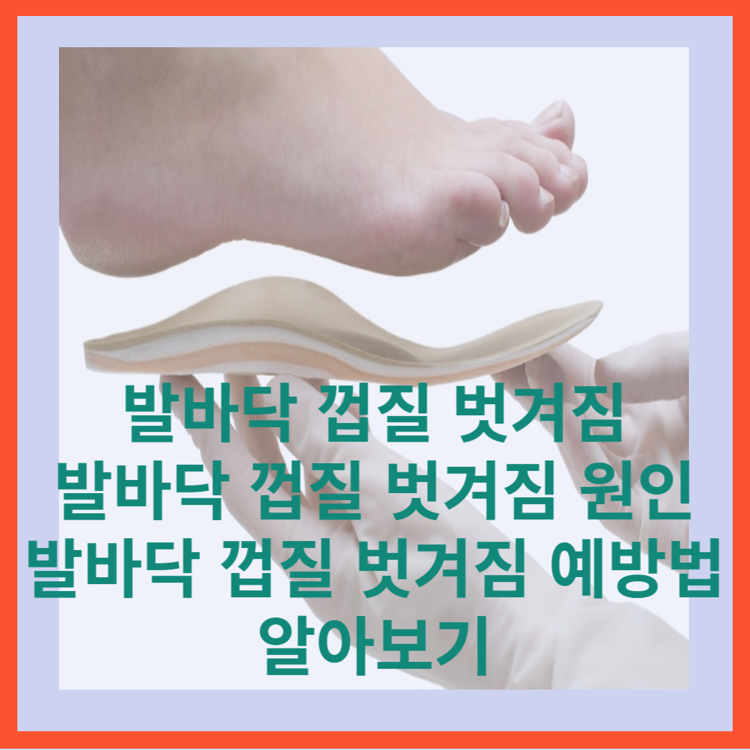  발바닥 껍질 벗겨짐,발바닥 껍질 벗겨지는 원인,발바닥 껍질 벗겨짐 예방법 알아보기