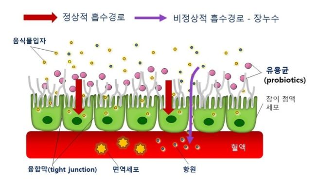 염증 수치가 높으면