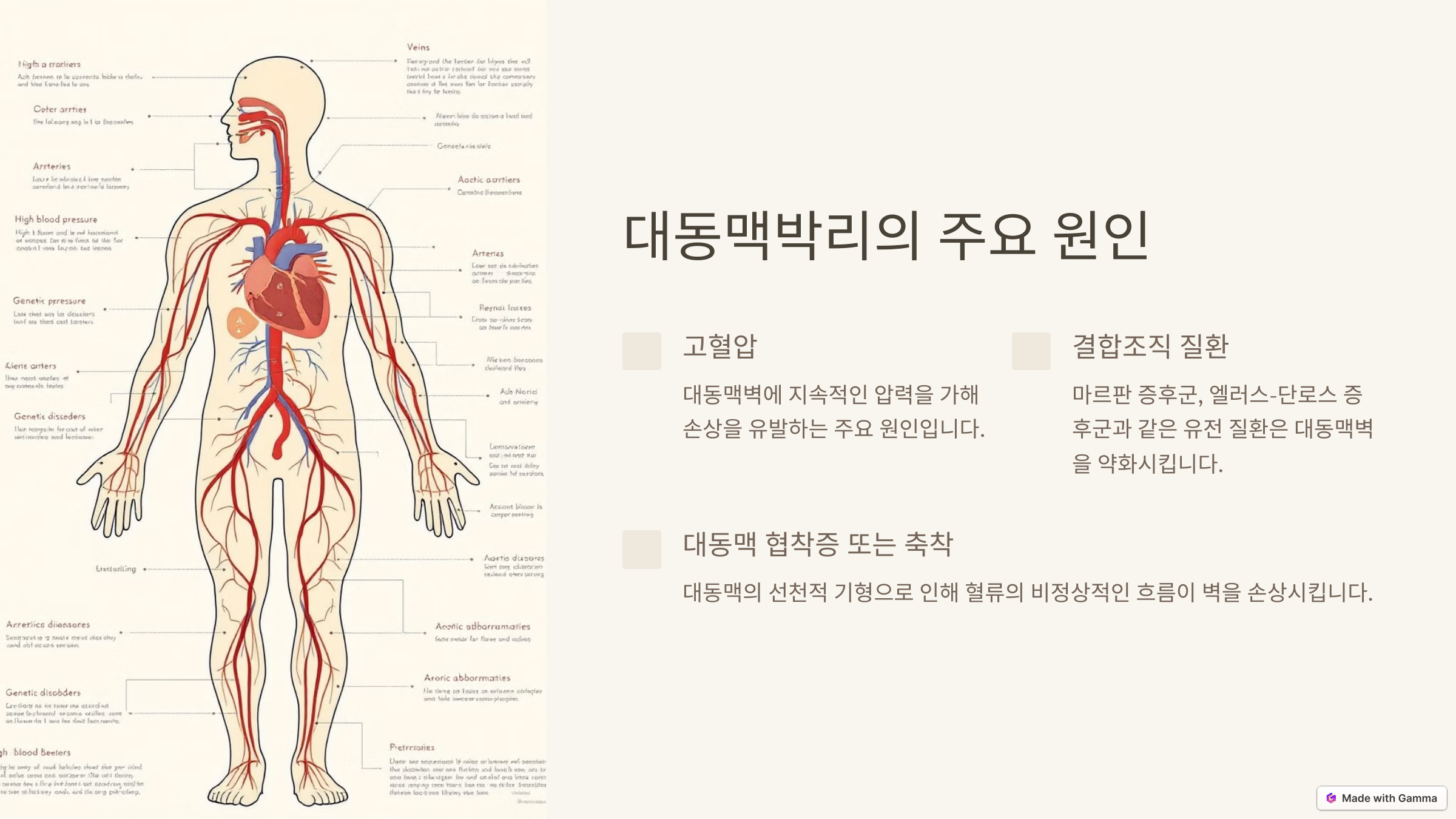 대동맥박리의 주요 원인