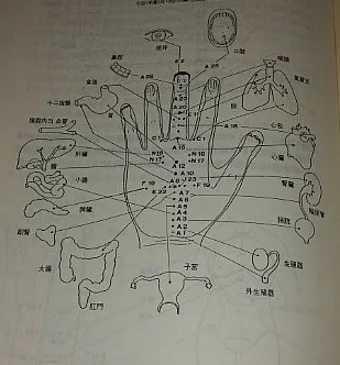두통 수지침 편두통 혈자리_16