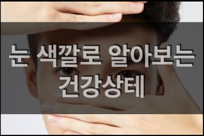  눈 색깔로 알아보는 건강상태