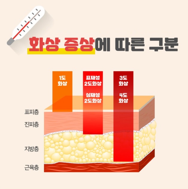 화상 분류