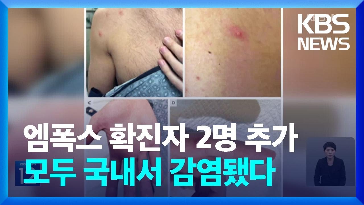 mpox 증상 (feat. 감염 경로) 최신 21