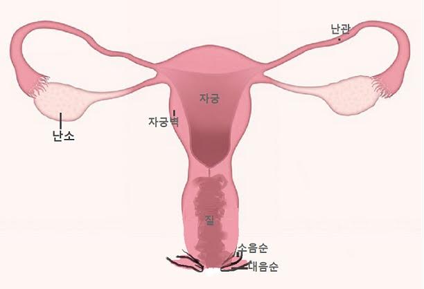 난소암