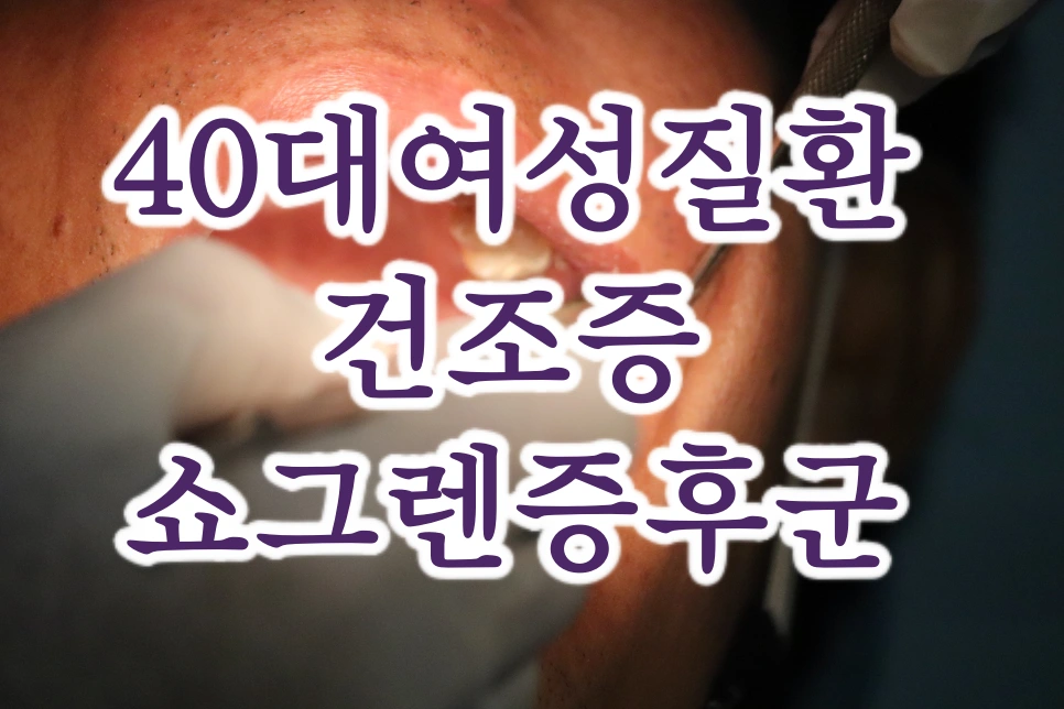 구강 검사