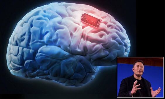 뇌에 칩 이식을 설명하는 머스크