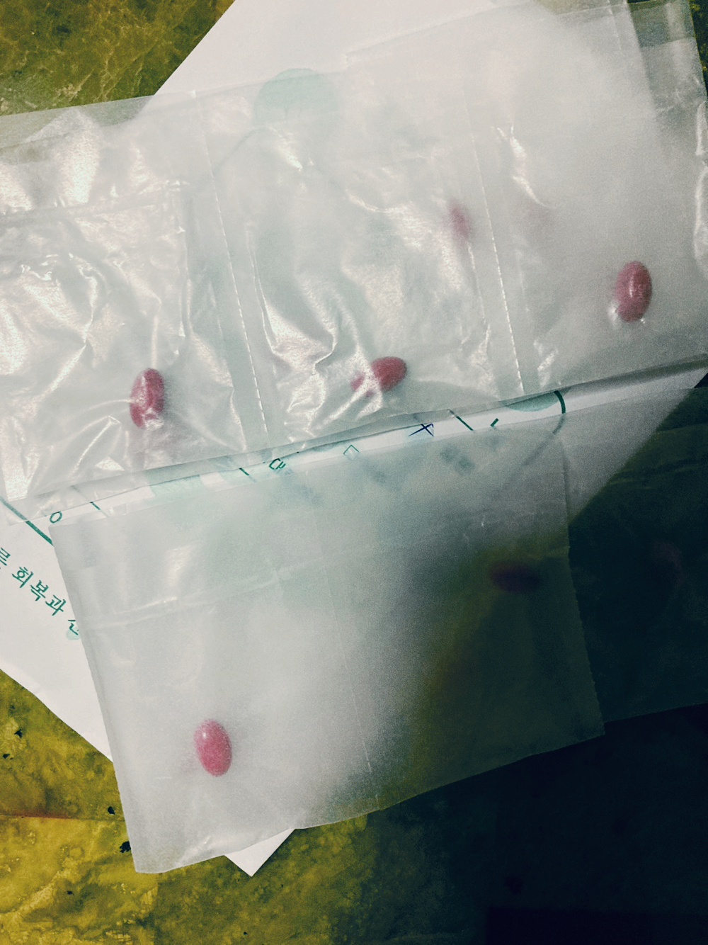  로아큐탄 부작용 개인적인 후기