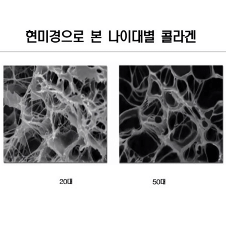 먹는-피부-영양제-복용으로-동안과-노안으로-나뉘는-모습