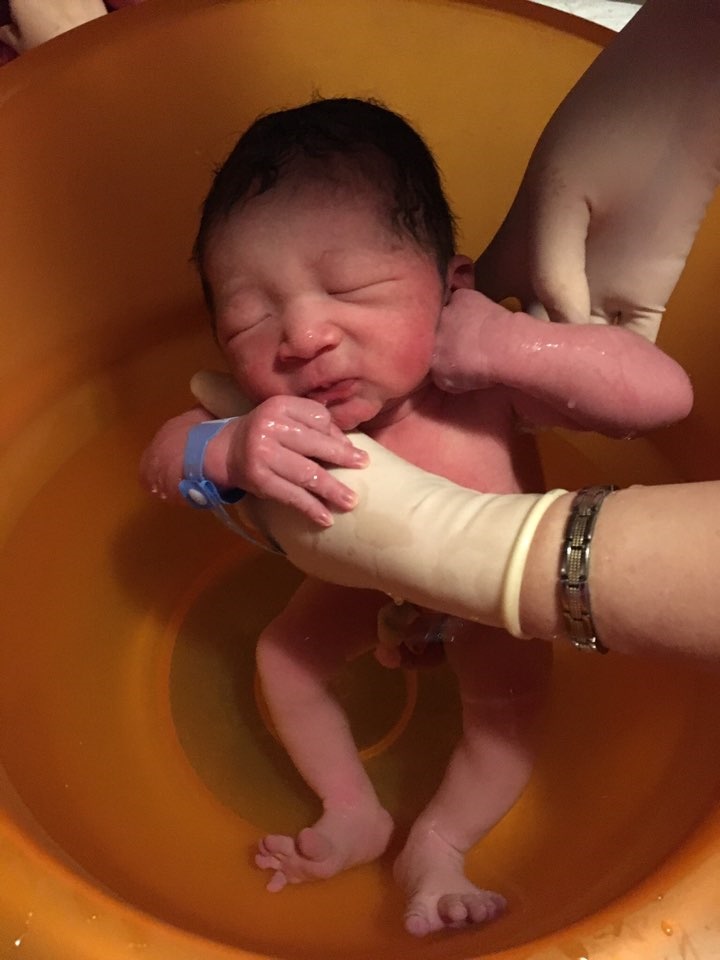 치료 너무 걱정하지 마세요 신생아 황달 원인과 수치, 12