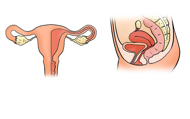 골반염증상 자궁경부,자궁부속기통증