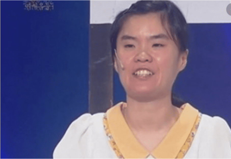  햇빛 알레르기 故박지선 지병맞나
