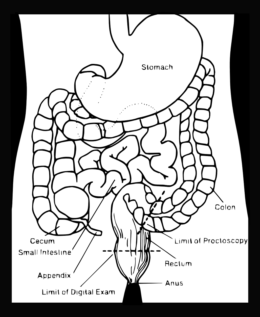 위염 증상