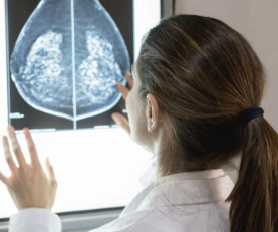 유방암 2기 생존율