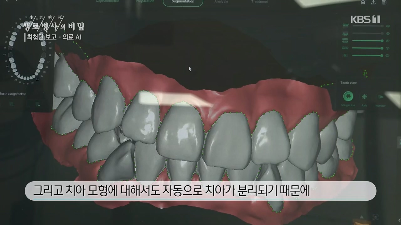 생로병사의 비밀.E869.230518p.H264-F1RST.mp4_20230518_200715.772.jpg