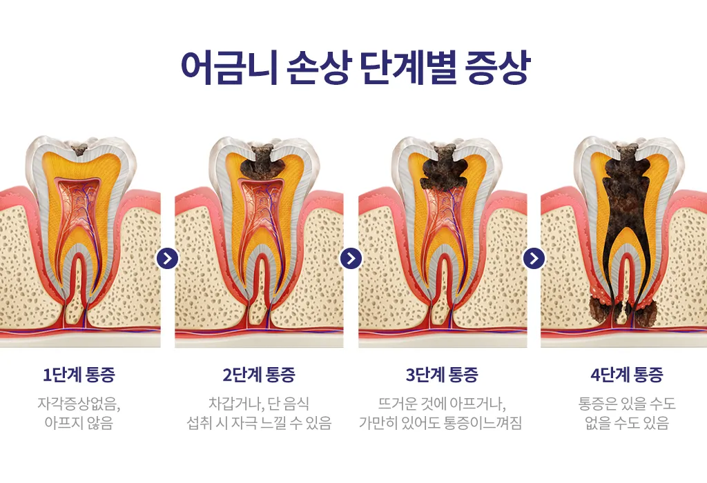 어금니 칫솔 사용법 선택방법 실사용 후기_4