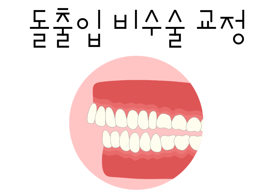 비수술적 돌출입 교정 사례와 후기