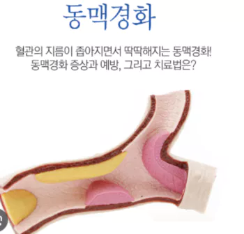 동맥경화-텍스트1