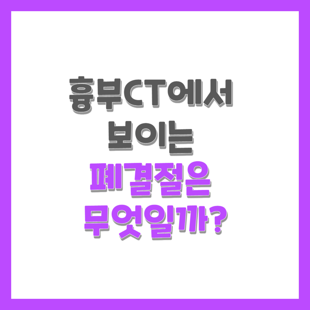  흉부CT에서 보이는 폐결절은 무엇일까?