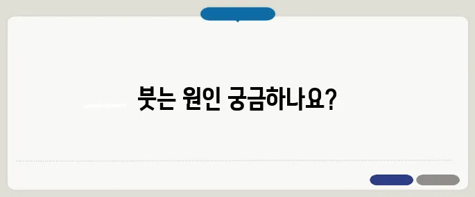 눈두덩이가 붓는 이유