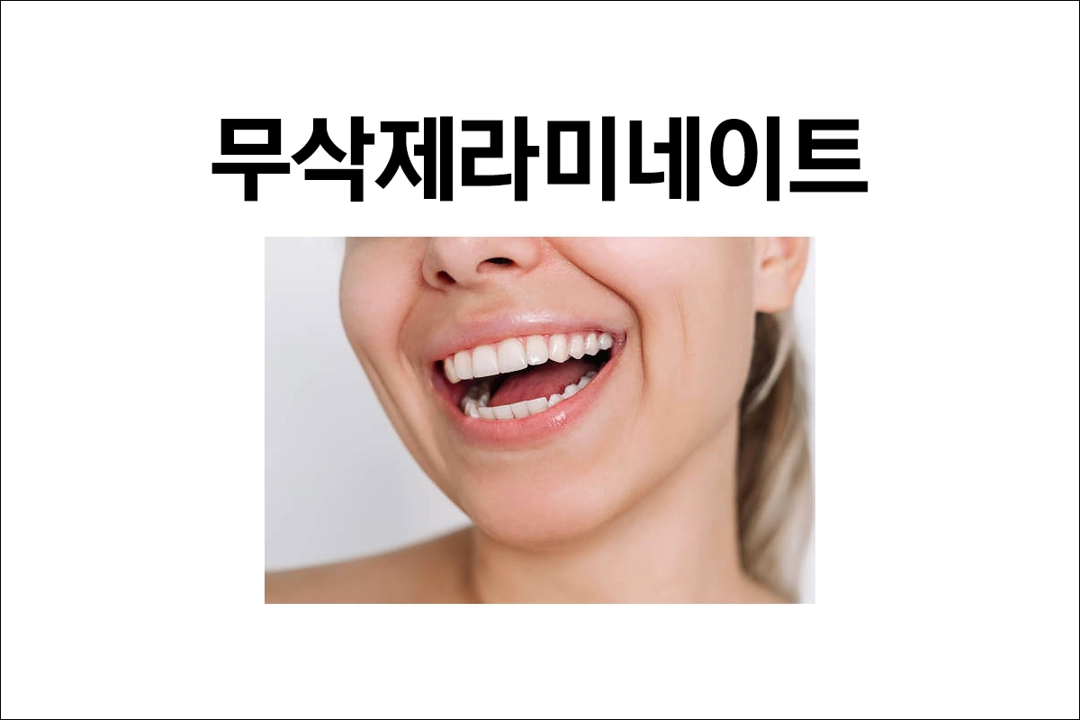 무삭제 라미네이트 주의사항