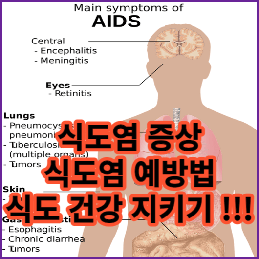  식도 통증 식도 기도 차이 식도 위치 식도 이물감 식도의 모든것 !!! 식도건강 파헤쳐보기 !!!