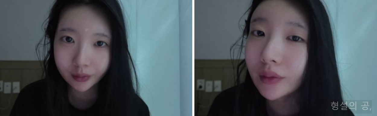 유노피부 이미지