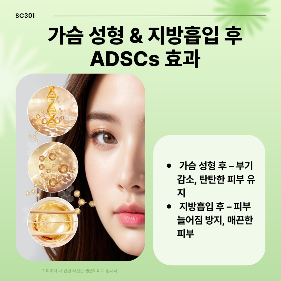 img 가슴 성형, 지방흡입 후 빠른 회복! ADSCs로 피부 재생과 탄력 회복
