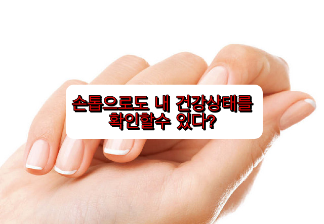  손톱에 내건강 상태가 보인다?? | 손톱으로 보는 나의 건강상태 6가지(건강)