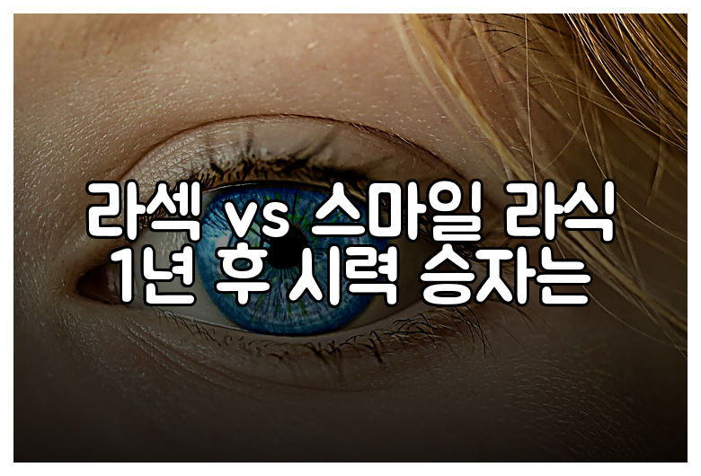 라섹 vs 스마일 라식 1년 후 시력 승자는