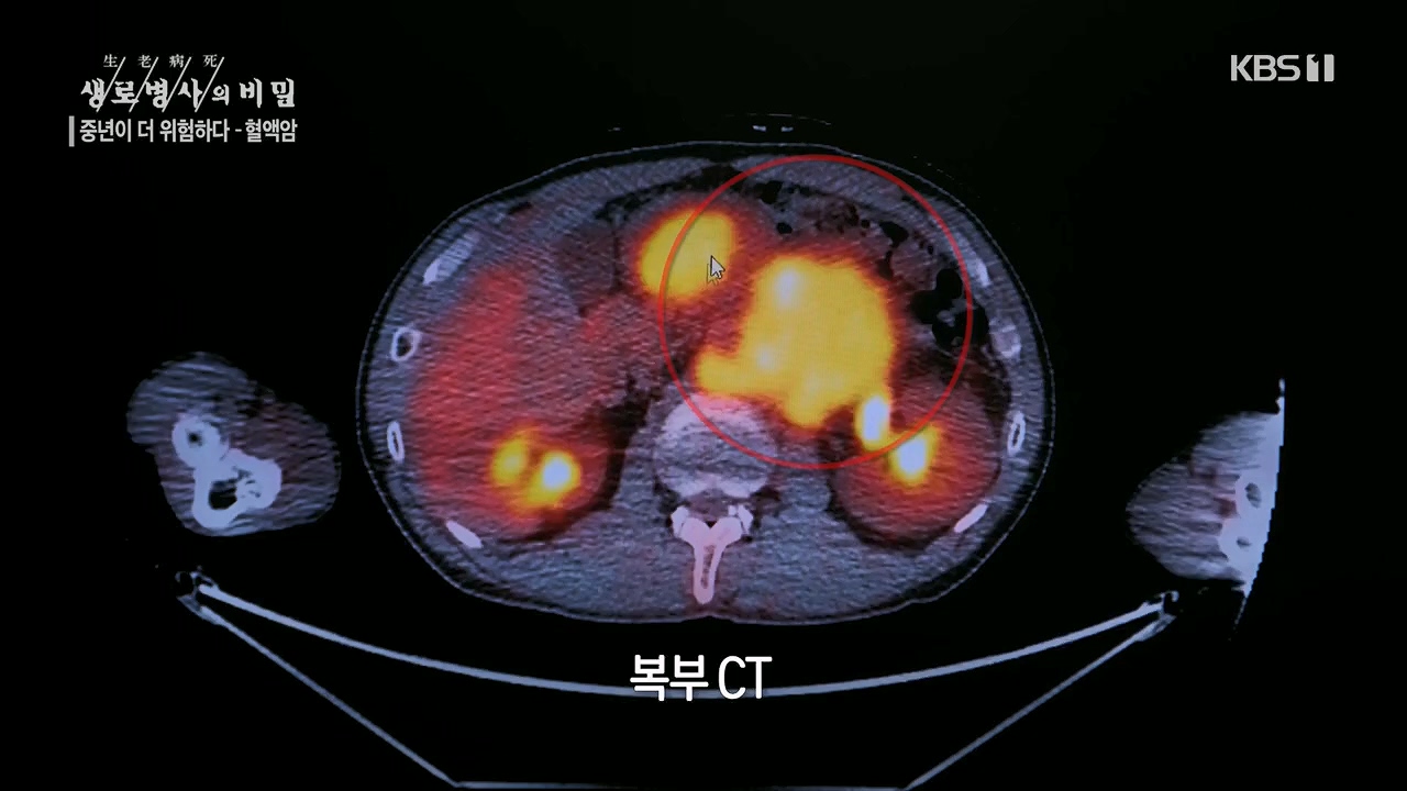 생로병사의 비밀.E868.230511p.H264-F1RST.mp4_20230511_201642.631.jpg