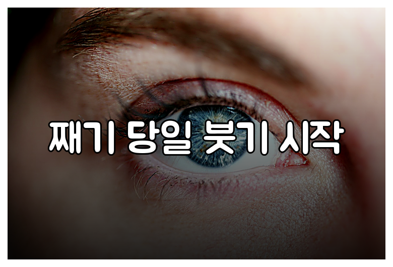 째기 당일 붓기 시작